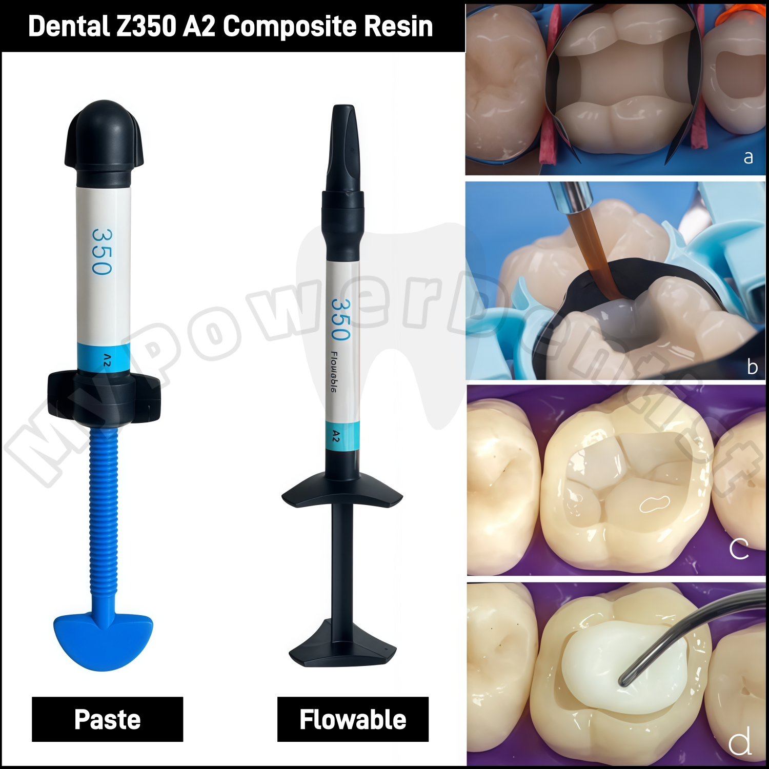 Teeth Whitening Veneers - Z350 A2 Dental Composite Resin Light