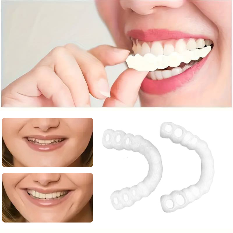 Teeth Whitening Veneers - On Smile Dental Upper Lower Fake