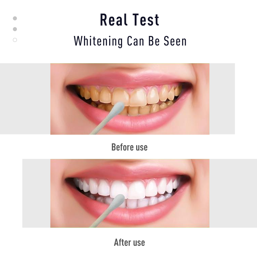 Pen Tooth Gel White  Kit Clean - Whitening Pen Bleach recensie en prijs