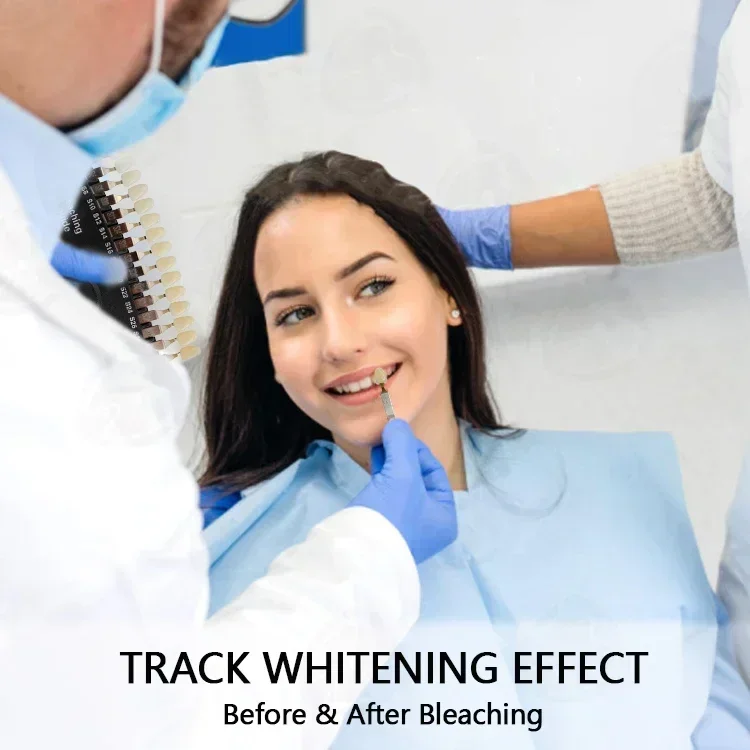 Professional Teeths Whitenings - Teeth Whitening Shade Guide recensie en prijs