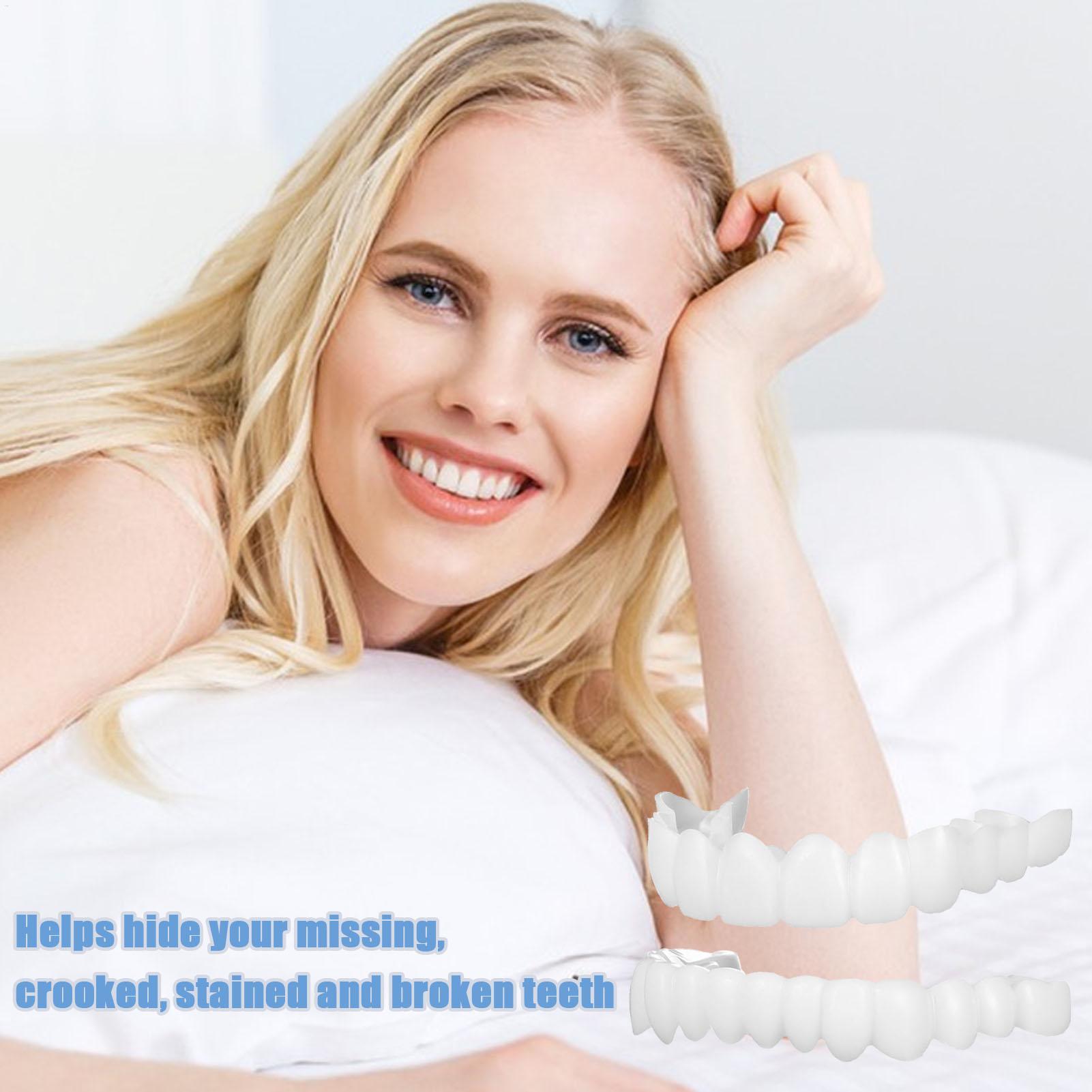 Dental Upper Lower Fake Teeth  - Teeth Whitening Veneers recensie en prijs