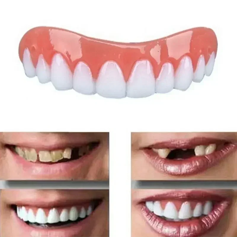 New False Teeth Silicone Upper - Teeth Whitening Veneers recensie en prijs