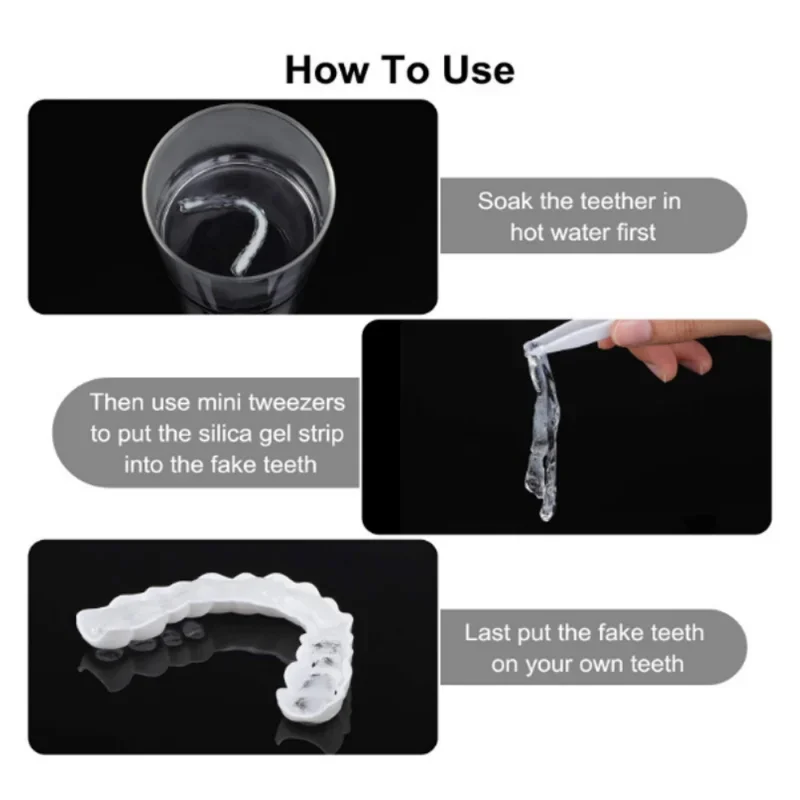 Denture Cover Veneer Snap-on T - Teeth Whitening Veneers recensie en prijs