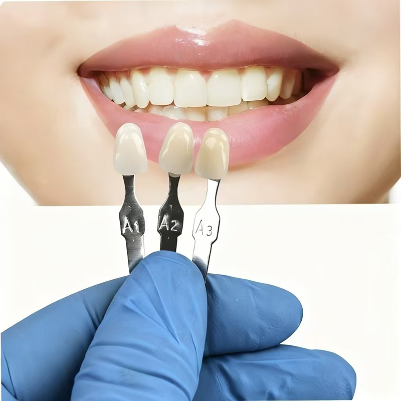 VITA 16 Colors Teeth Shade Gui - Teeth Whitening Shade Guide recensie en prijs