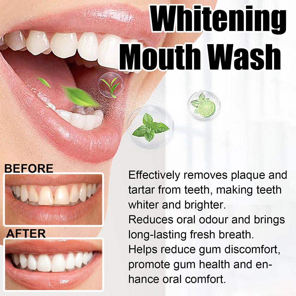 Coconut Mint Pulling Oil Mouth - Teeth Whitening Oil Pulling recensie en prijs