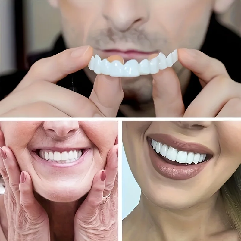 Color Matching Natural Teeth V - Teeth Whitening Options recensie en prijs