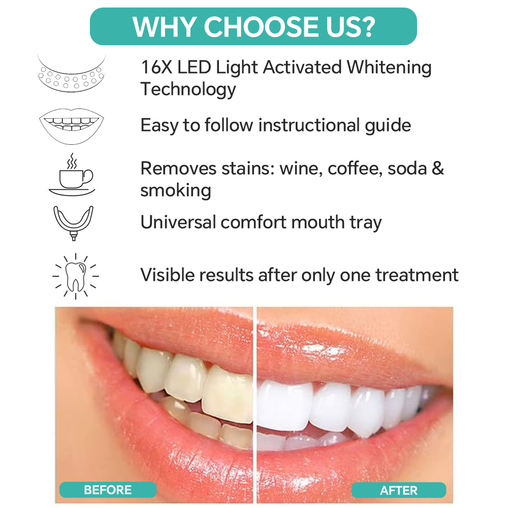 Teeth Whitening Accelerator Li - Teeth Whitening With Blue Light recensie en prijs