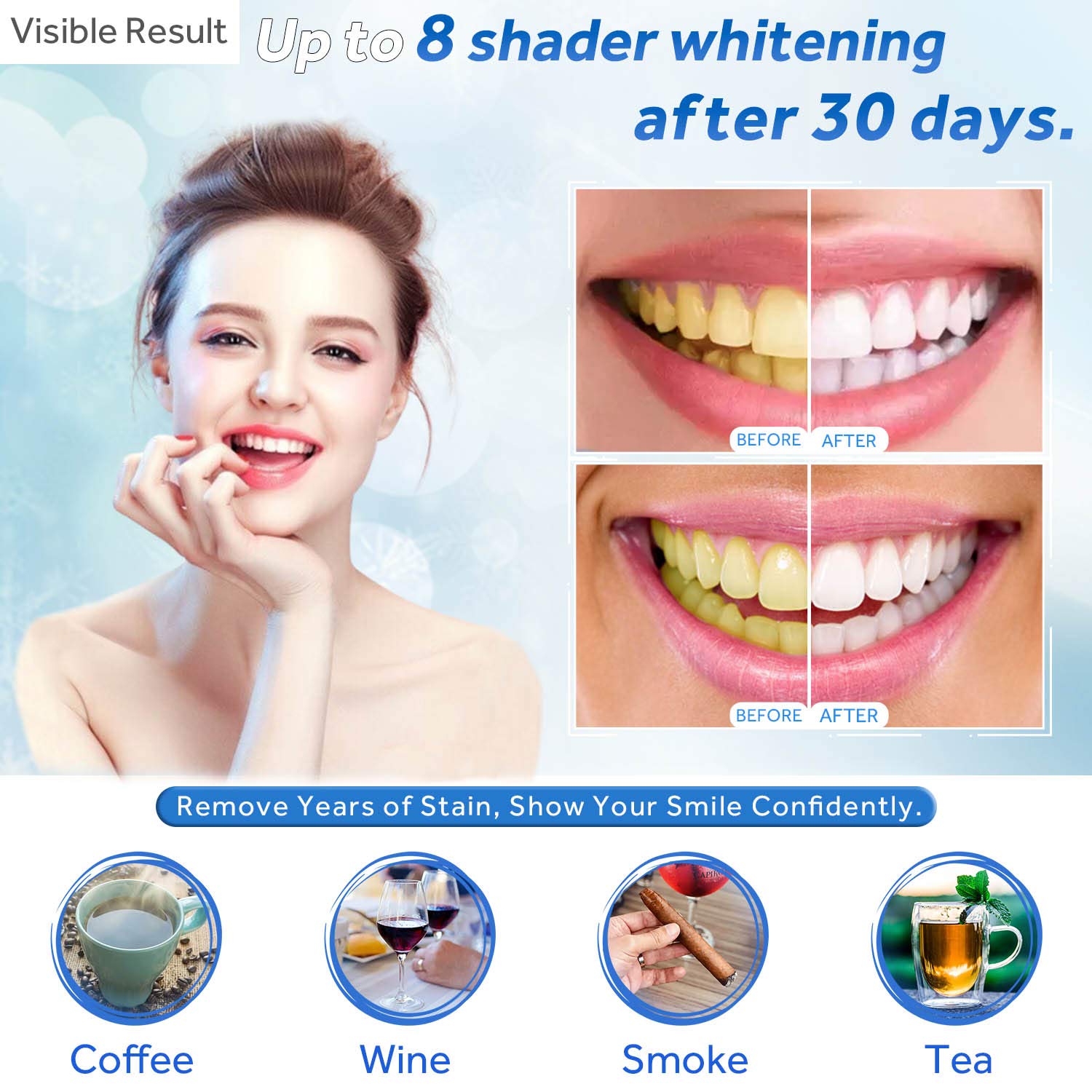 Teeth Whitening Gel Refill Syr - Teeth Whitening Uv Light recensie en prijs