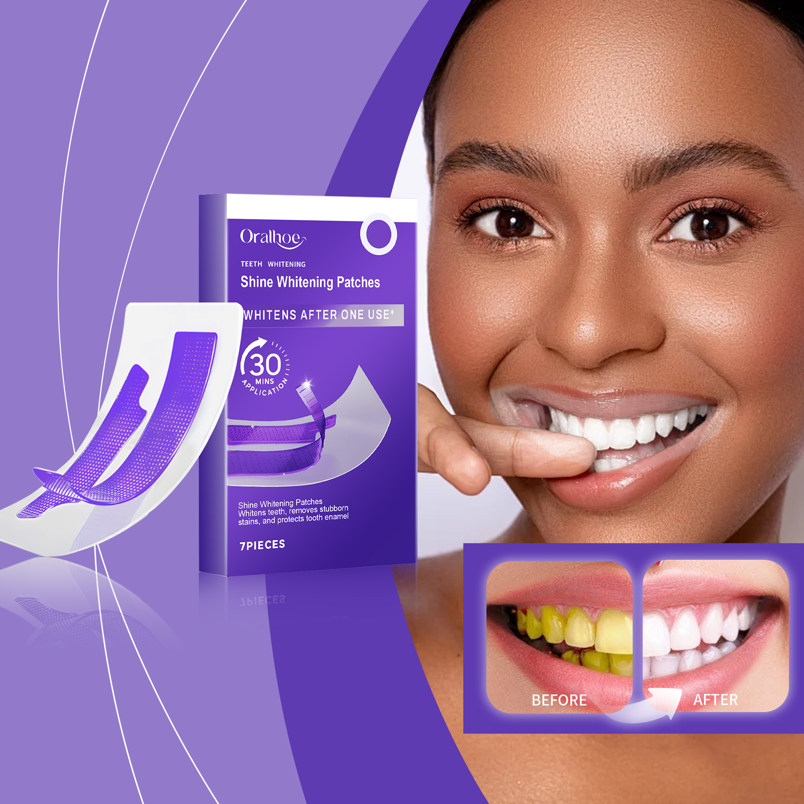 Purple Teeth Whitening Strips  - Teeth Whitening Strips Crest recensie en prijs