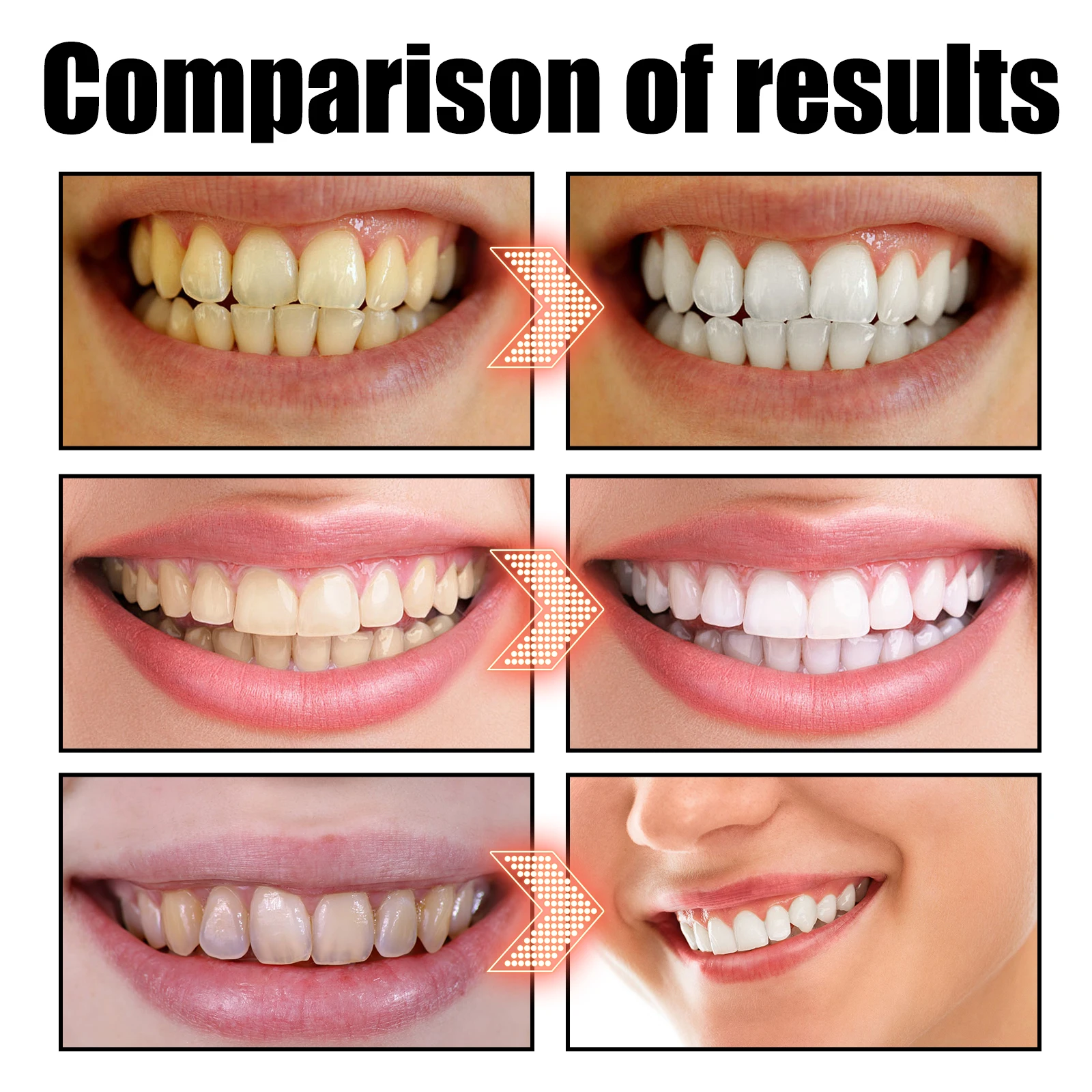 Coconut Mint Pulling Oil Mouth - Teeth Whitening Oil Pulling recensie en prijs