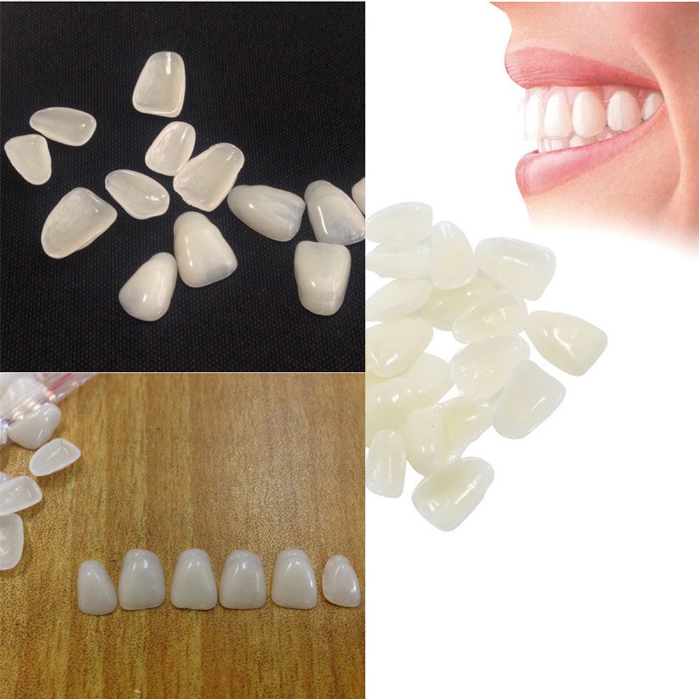 70PCS/Package Dental Ultra-Thi - Teeth Whitening Veneers recensie en prijs