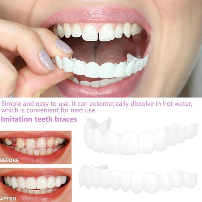 Snap On Teeth Veneers Instant  - Teeth Whitening Veneers recensie en prijs
