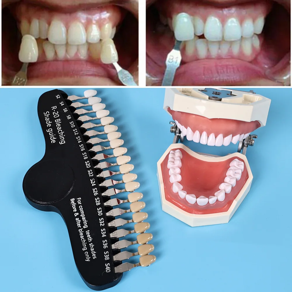ELIJAH R-20 Bleaching Shade Gu - Teeth Whitening Shade Guide recensie en prijs