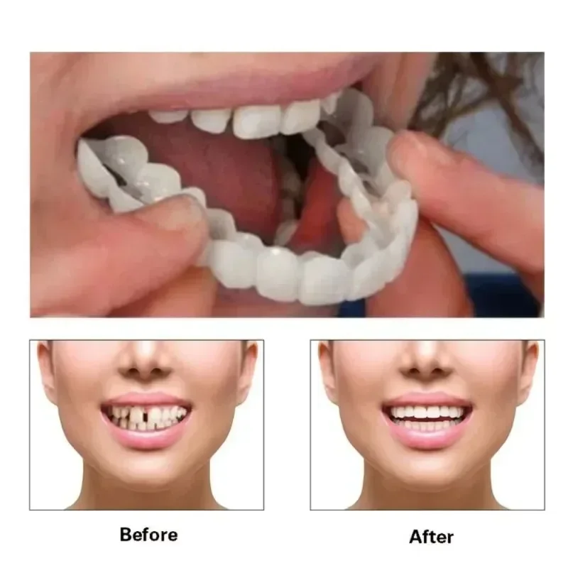 Fake Tooth Cover Perfect Fit T - Teeth Whitening Veneers recensie en prijs