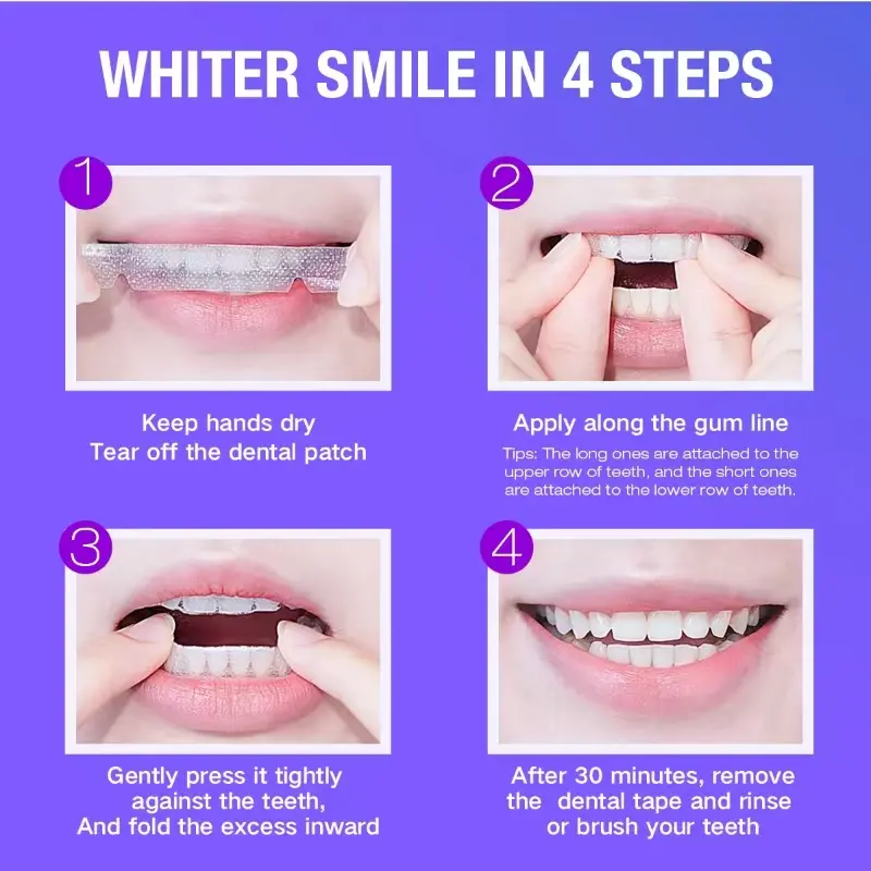Teeth Whitening Kit - 5X LED L - Teeth Whitening Strips Crest recensie en prijs