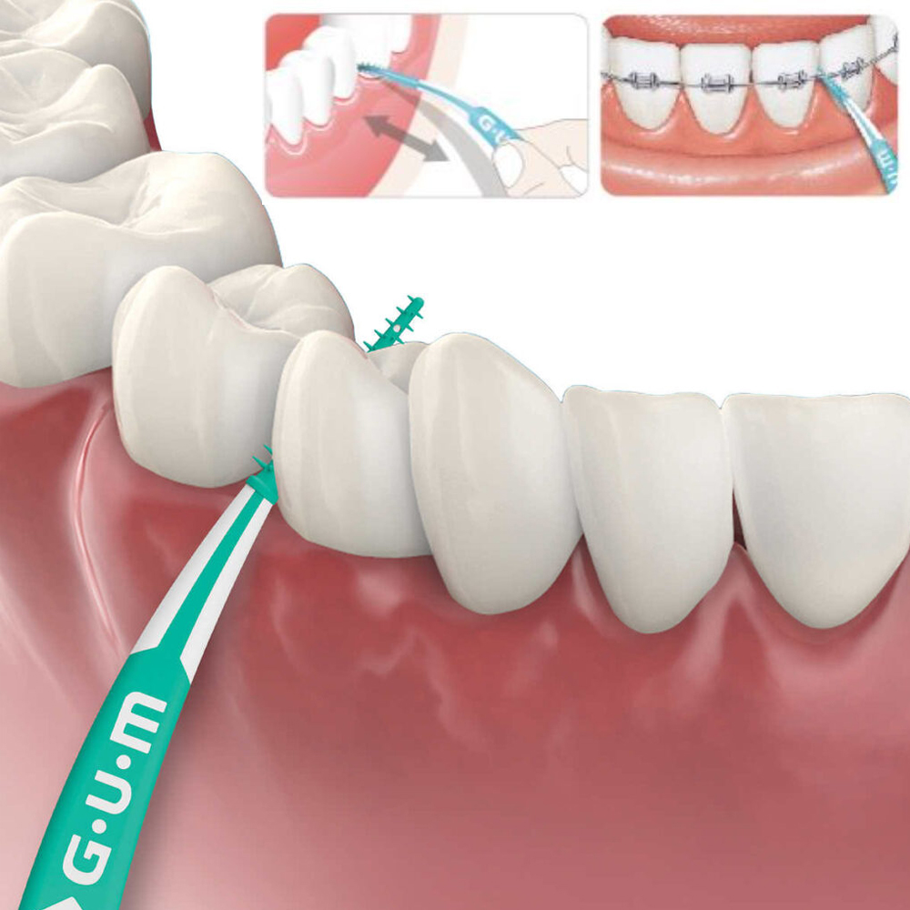 Gum Soft Picks Advanced Small  - Teeth Whitening In Japan recensie en prijs
