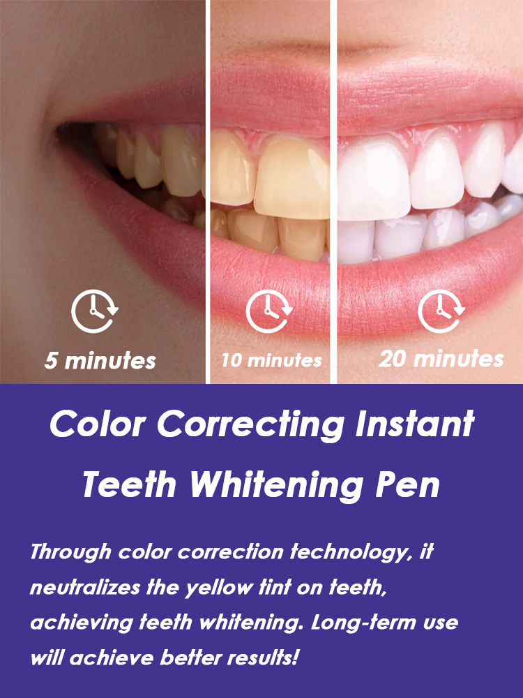 Teeth Whitening Pen Effective  - Whitening Pen Bleach recensie en prijs