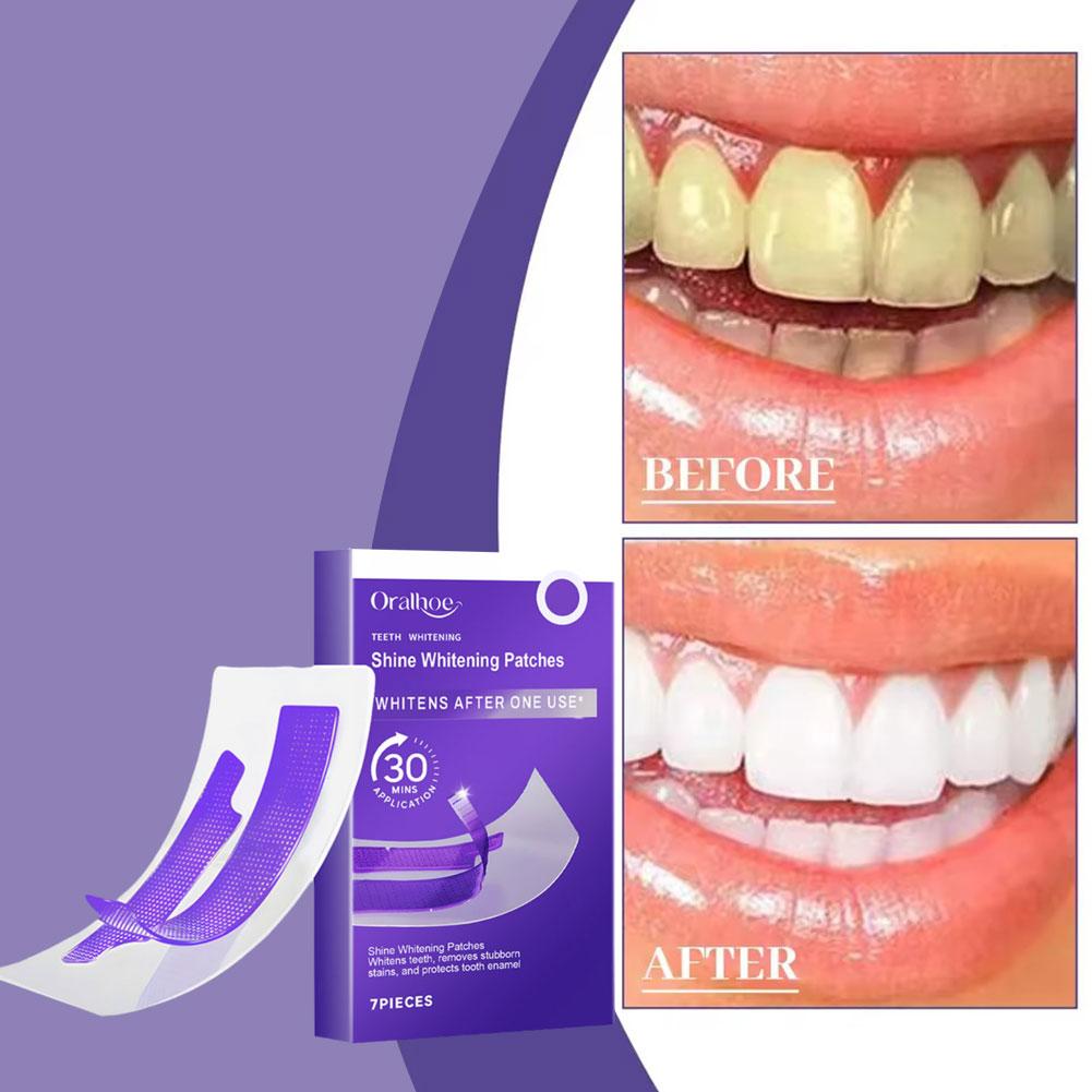 Purple Teeth Whitening Strips  - Teeth Whitening Strips Crest recensie en prijs