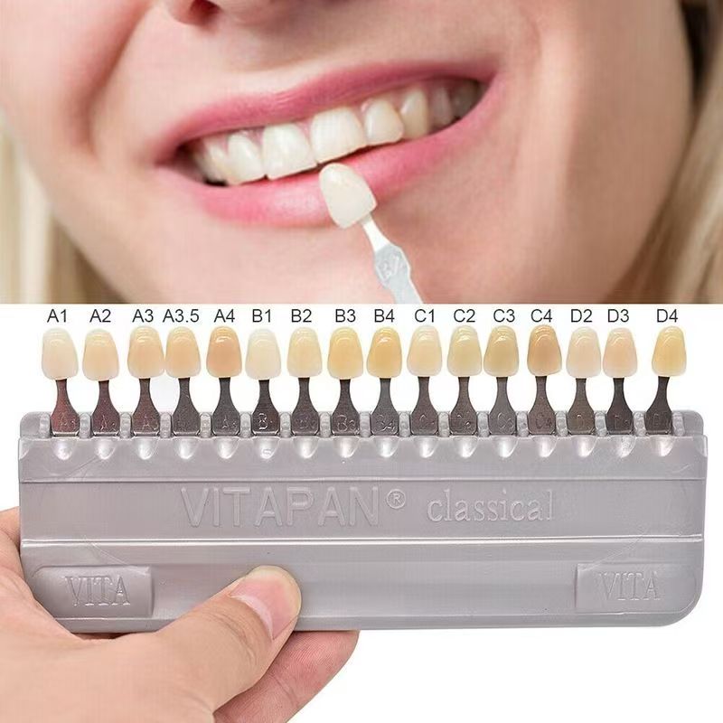 GULPOOE Dental 16 Colors Guide - Teeth Whitening Shade Guide recensie en prijs