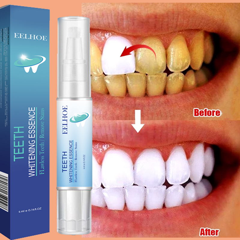 Teeth Whitening Pen Dental Ess - Whitening Pen Bleach recensie en prijs