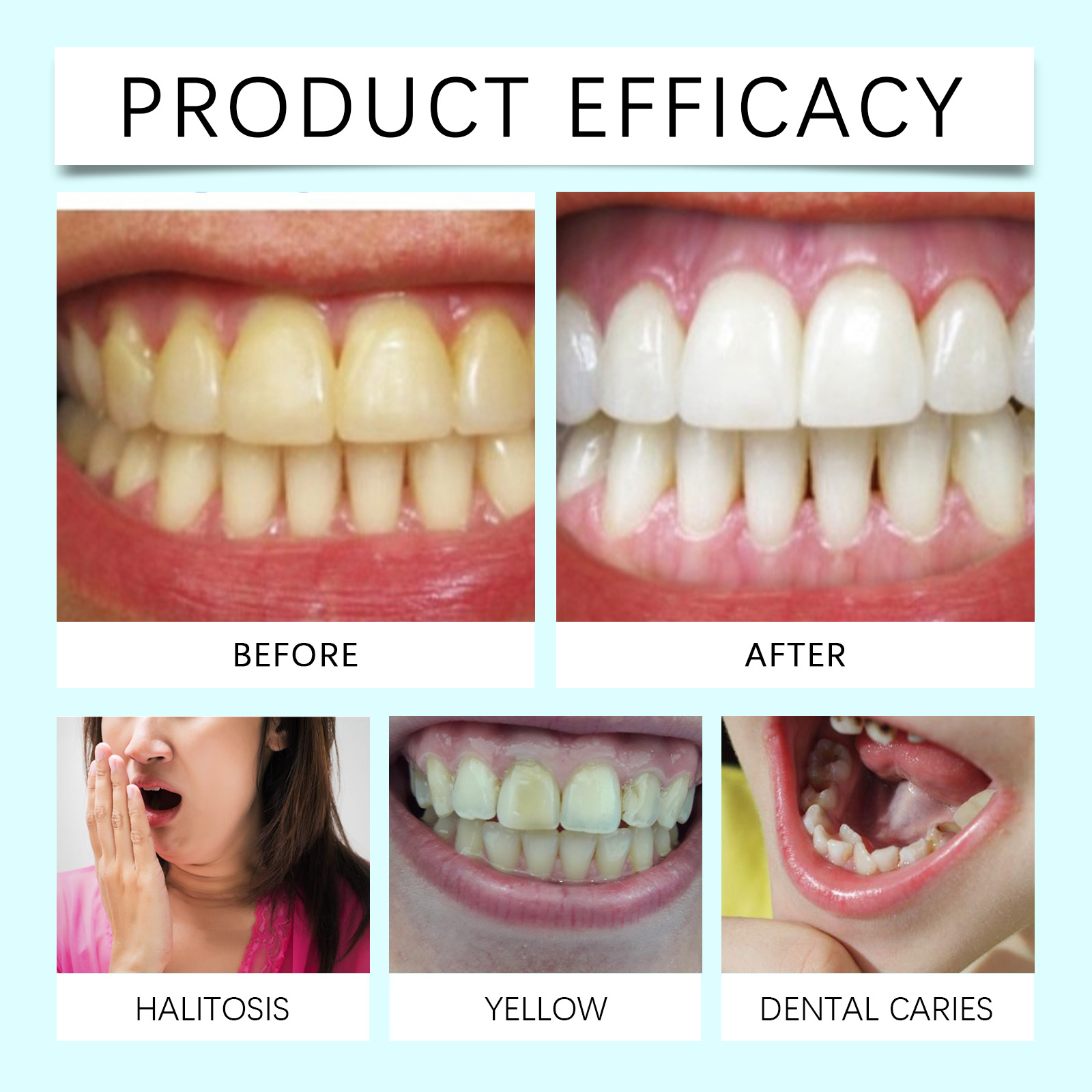Tooth Whitening Strips Remove  - Teeth Whitening Or Bleaching recensie en prijs