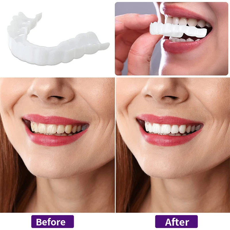Color Matching Natural Teeth V - Teeth Whitening Options recensie en prijs