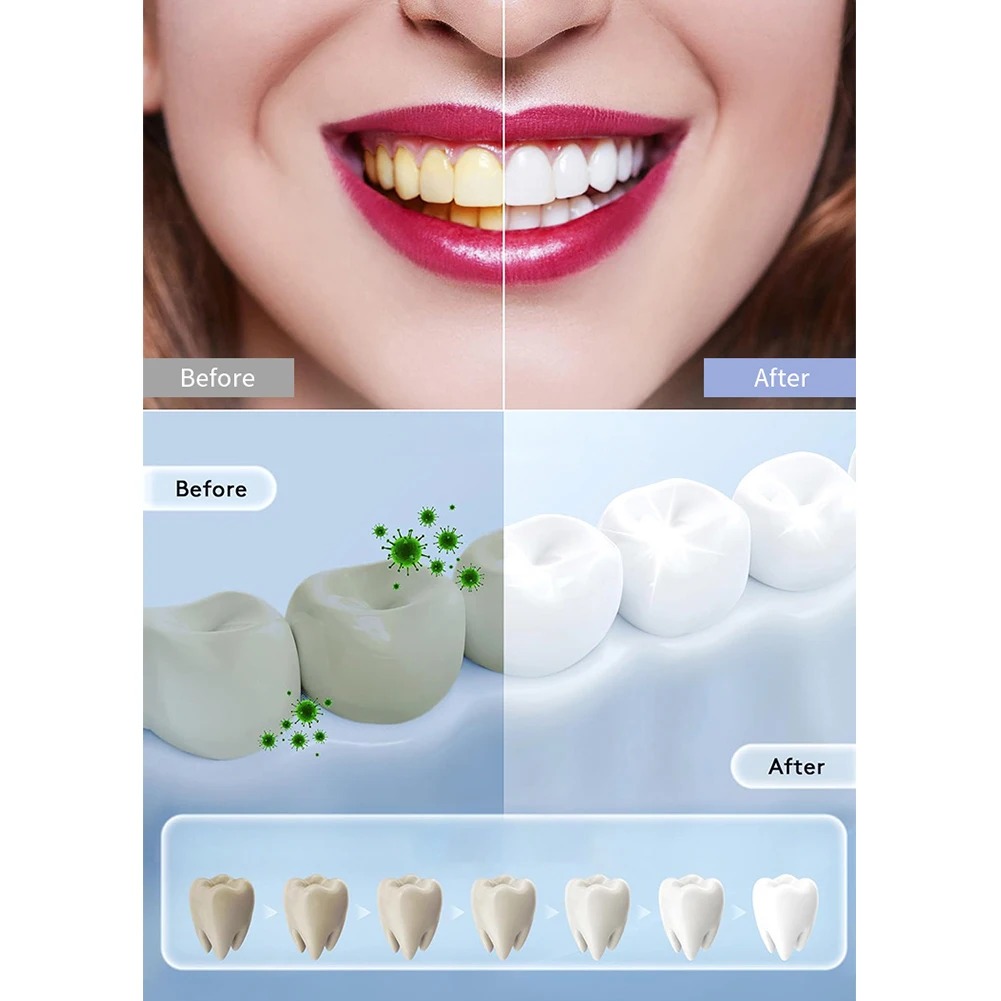 1PC Household Smart LED Teeth  - Teeth Whitening Uv Light recensie en prijs