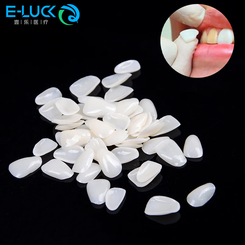 50pcs Dental Teeth Veneers Tem - Teeth Whitening Veneers recensie en prijs