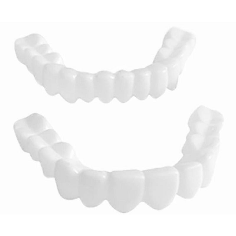 Chart Temporary Dental Braces  - Teeth Whitening Veneers recensie en prijs