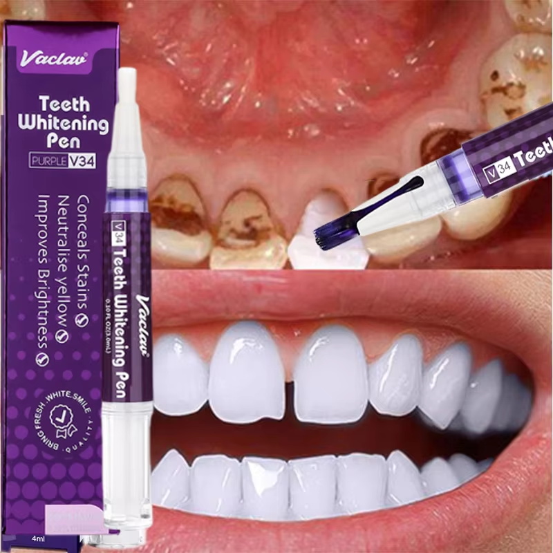 V34 Teeth Whtening Pen Toothpa - Whitening Pen Bleach recensie en prijs