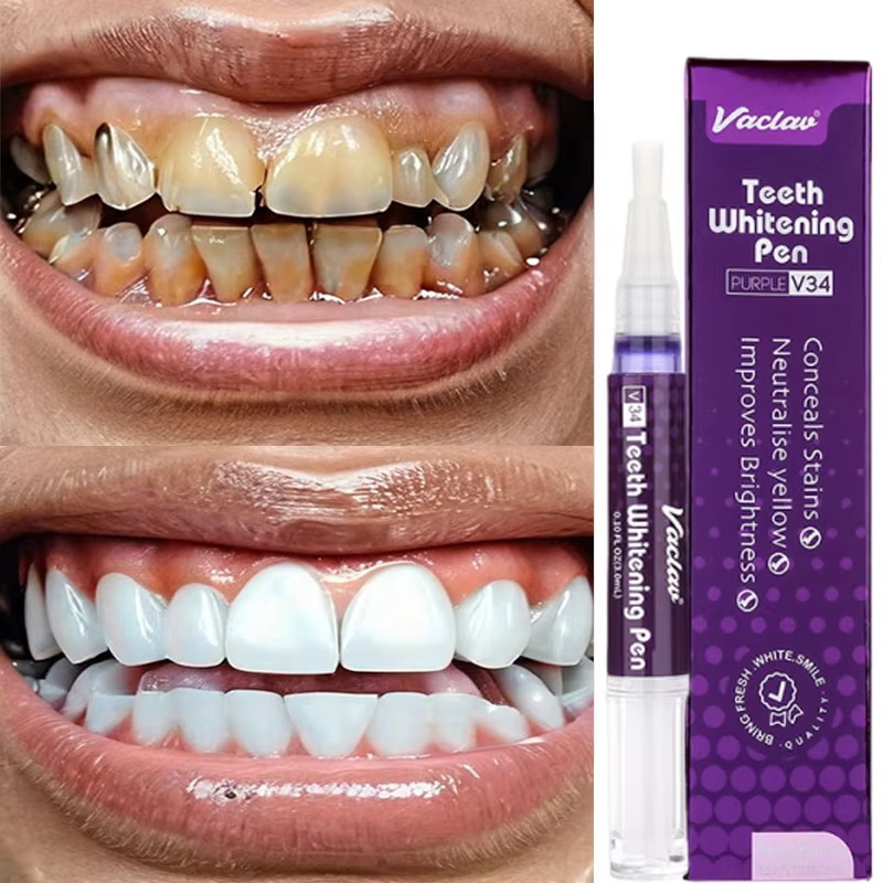 V34 Teeth Whtening Pen Toothpa - Whitening Pen Bleach recensie en prijs