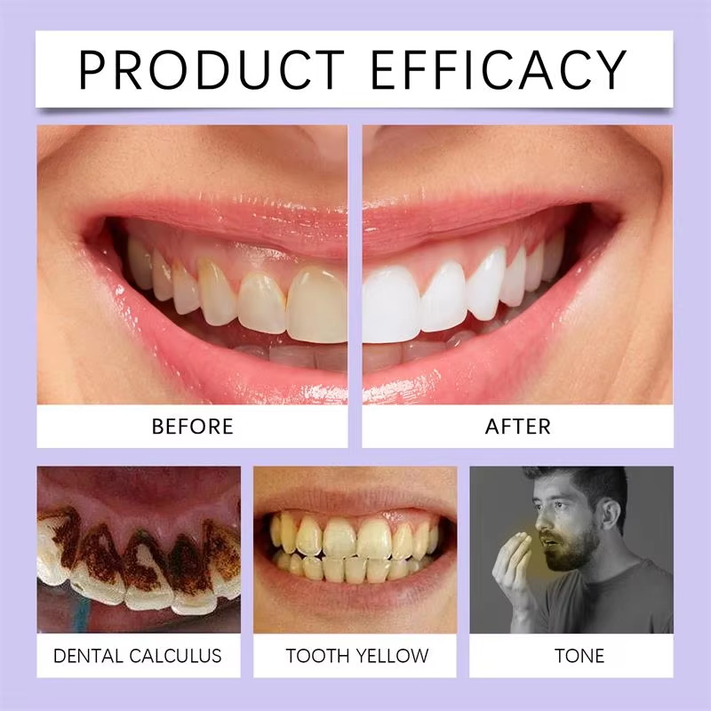 V34 Teeth Whtening Pen Toothpa - Whitening Pen Bleach recensie en prijs