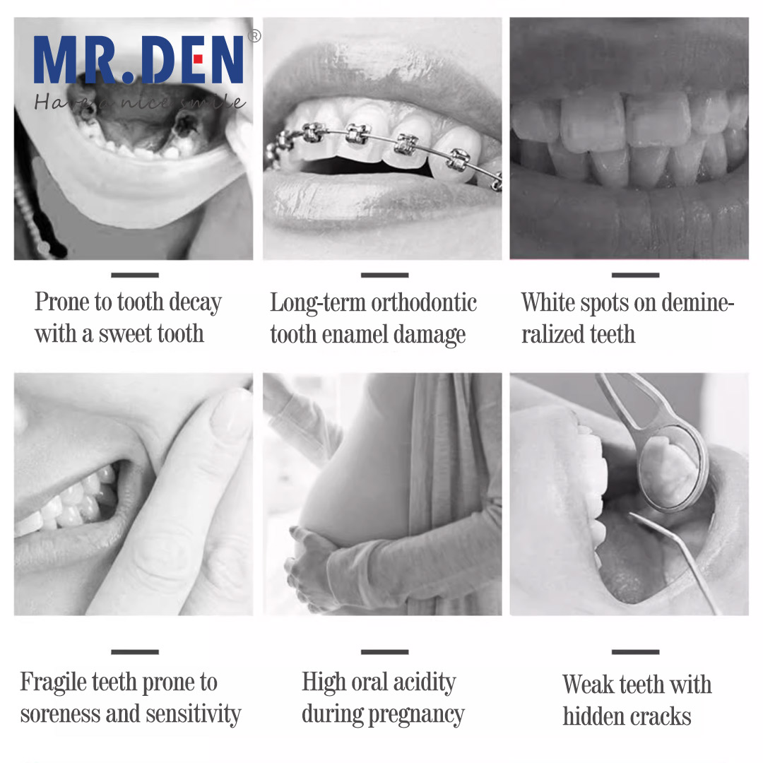Japan GC Fluoride Enhanced Den - Teeth Whitening In Japan recensie en prijs
