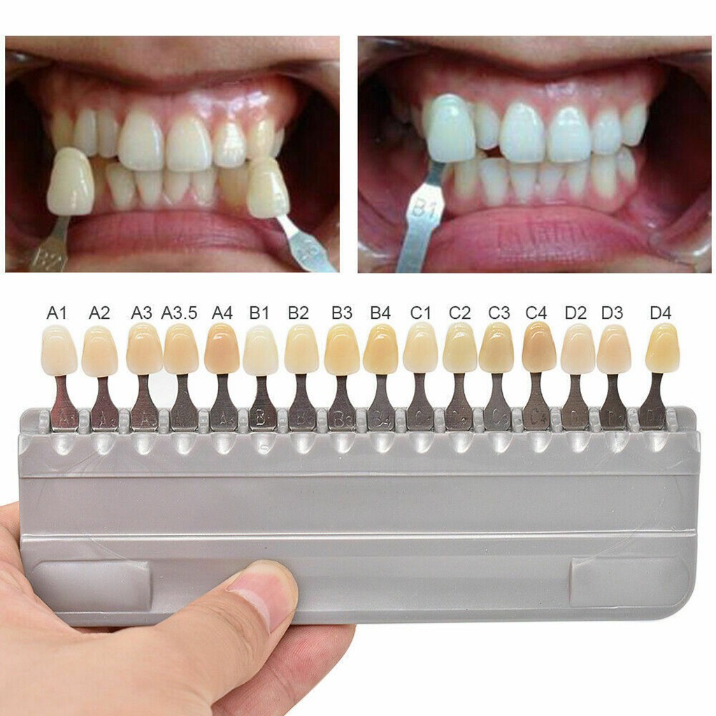 VITA 16 Colors Teeth Shade Gui - Teeth Whitening Shade Guide recensie en prijs
