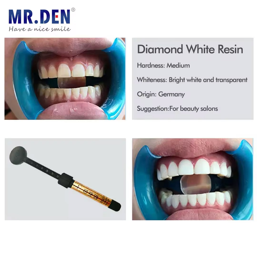 Nano enamel veneer material te - Teeth Whitening Veneers recensie en prijs