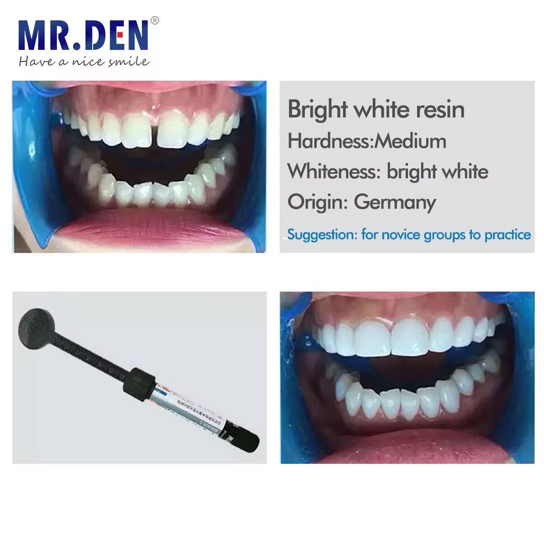 Nano enamel veneer material te - Teeth Whitening Veneers recensie en prijs