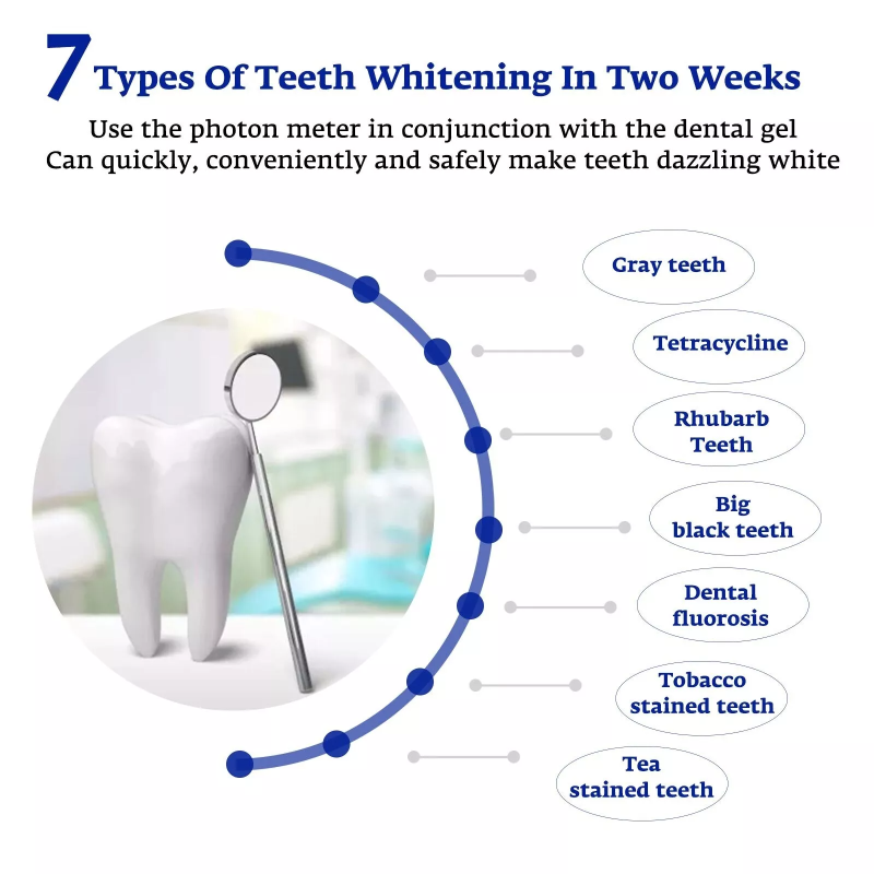 Teeth Whitening Accelerator Sm - Teeth Whitening With Blue Light recensie en prijs