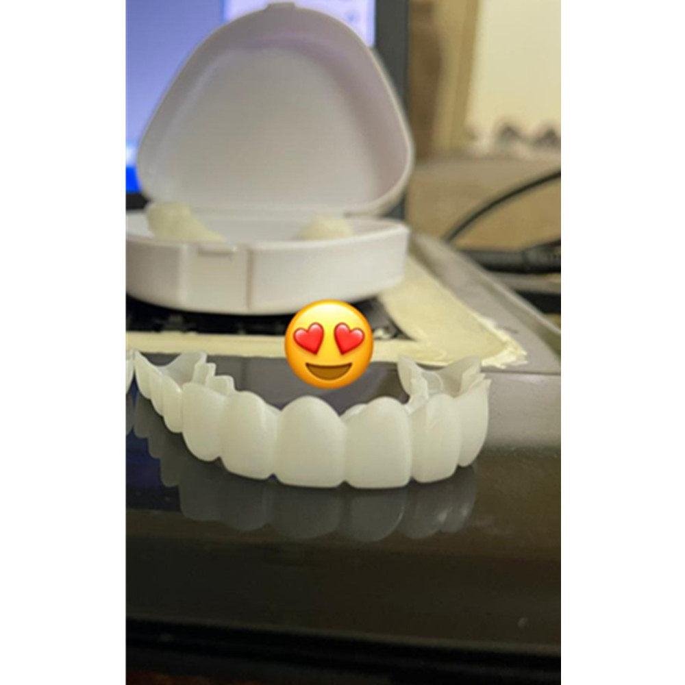 On Smile Dental Upper Lower Fa - Teeth Whitening Veneers recensie en prijs