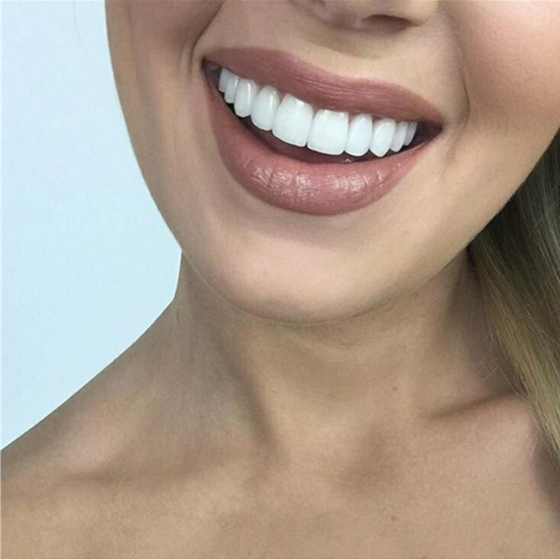 On Smile Dental Upper Lower Fa - Teeth Whitening Veneers recensie en prijs