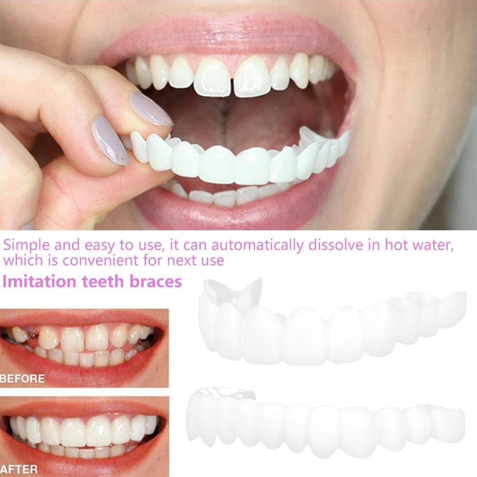 2pcs Men Women Temporary Teeth - Teeth Whitening Veneers recensie en prijs