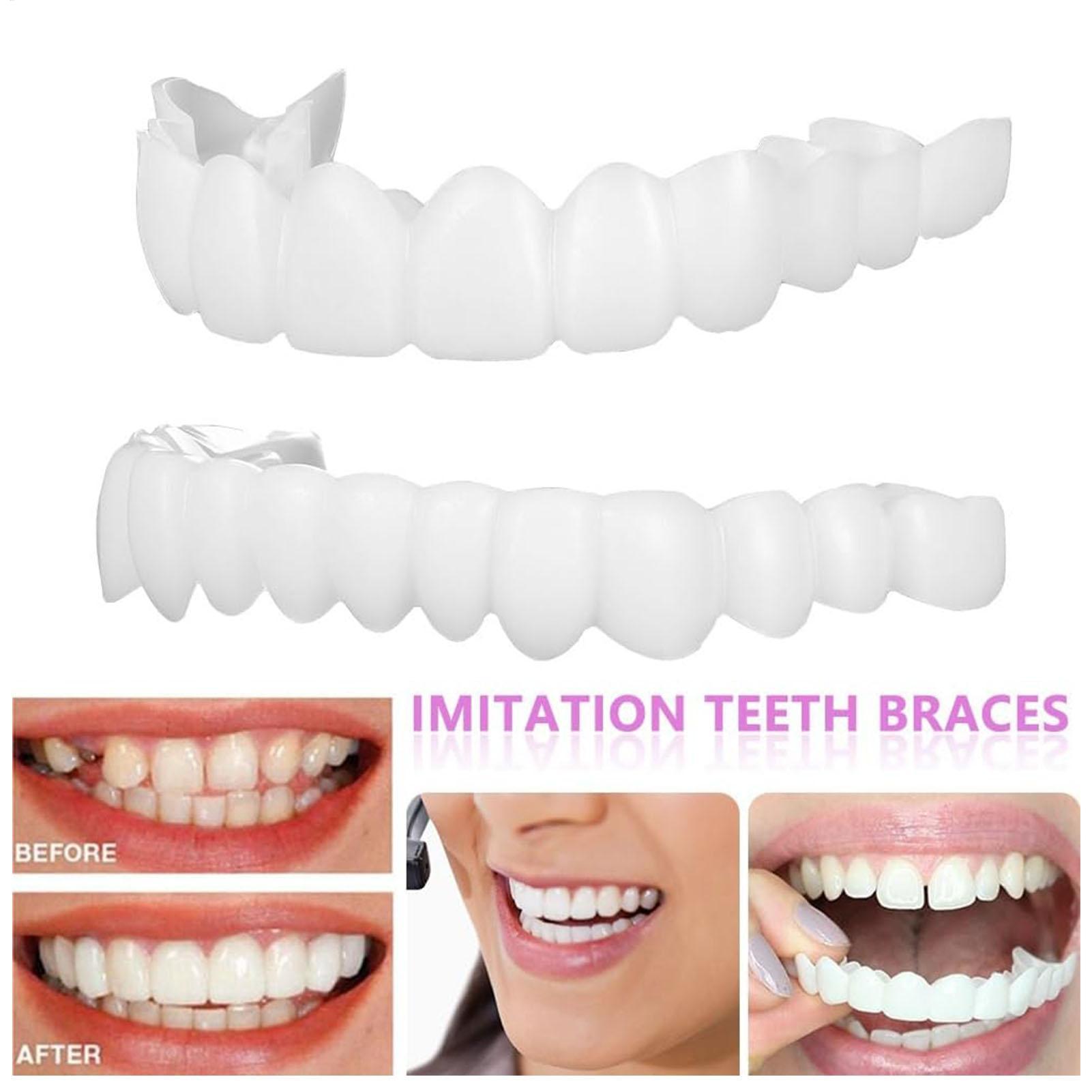 2pcs Men Women Temporary Teeth - Teeth Whitening Veneers recensie en prijs