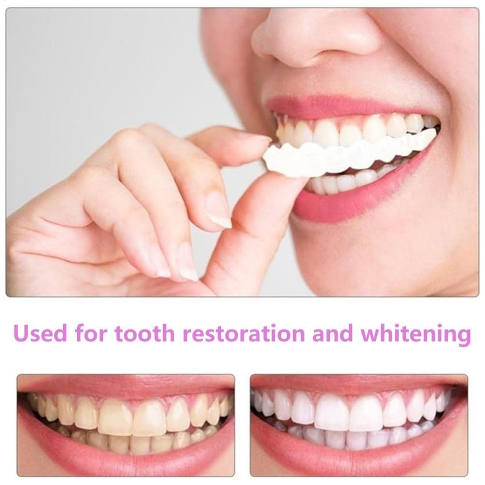 2pcs Men Women Temporary Teeth - Teeth Whitening Veneers recensie en prijs