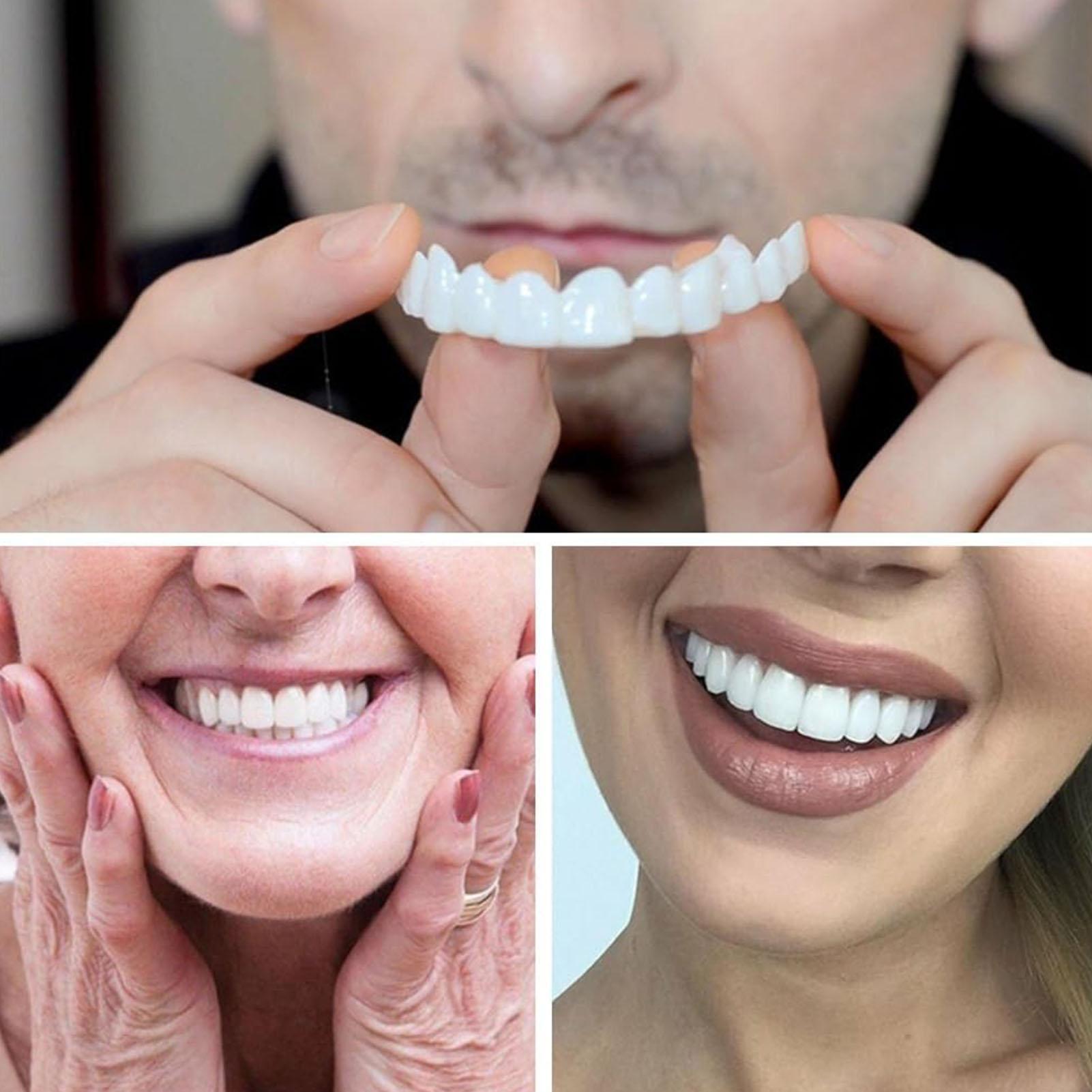 2pcs Men Women Temporary Teeth - Teeth Whitening Veneers recensie en prijs