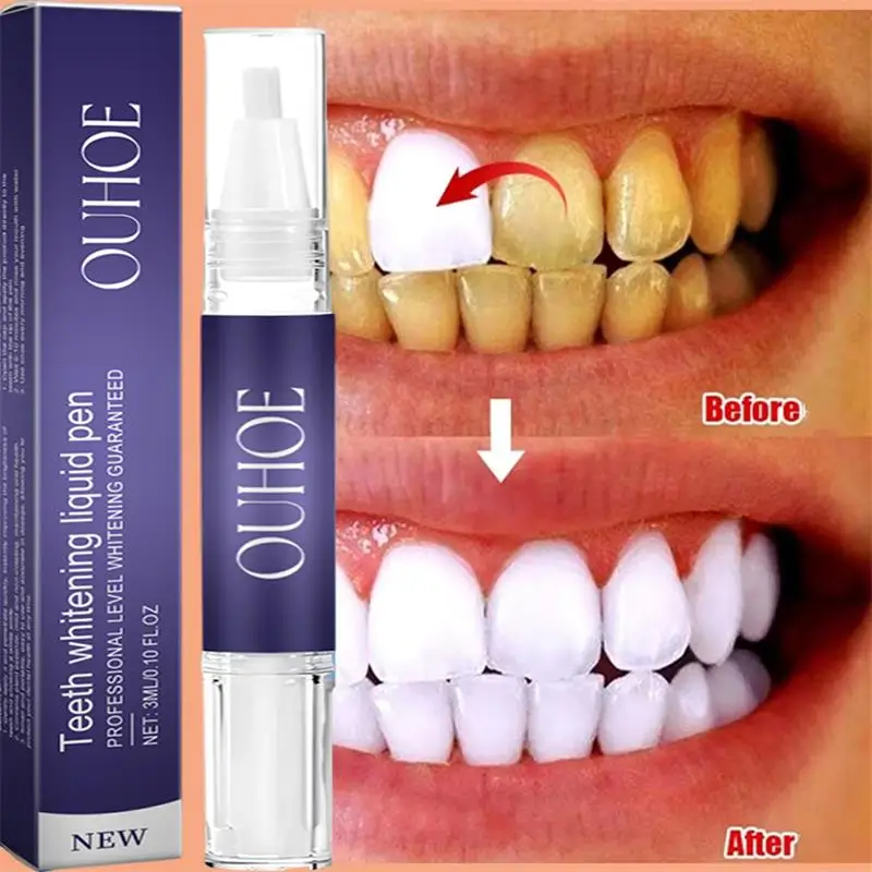 Fast Teeth Whtening Toothpaste - Whitening Pen Bleach recensie en prijs