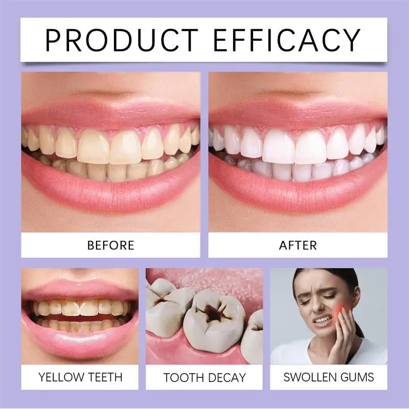 Fast Teeth Whtening Toothpaste - Whitening Pen Bleach recensie en prijs