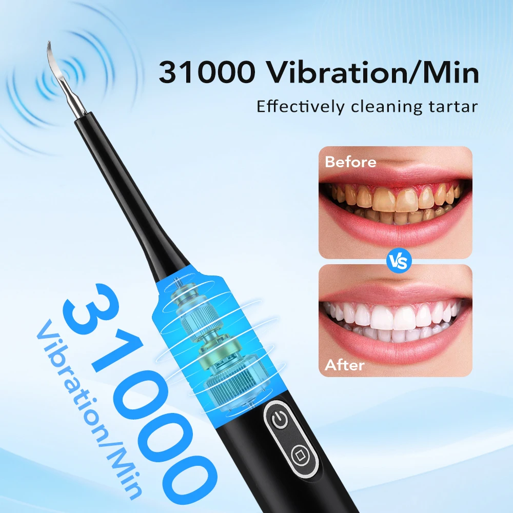 Electric Sonic Vibration Denta - Electric Toothbrush Sonic recensie en prijs