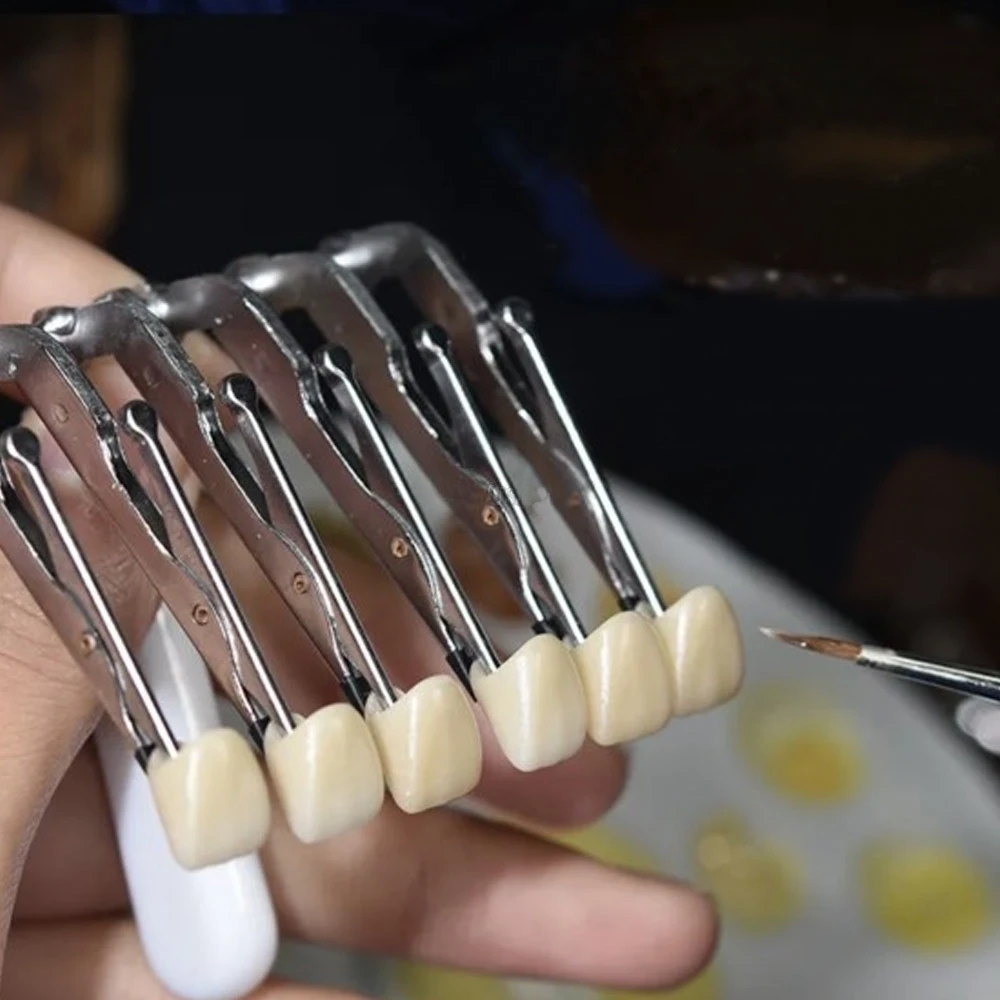 1pc Dental Veneer Porcelain Fa - Teeth Whitening Veneers recensie en prijs