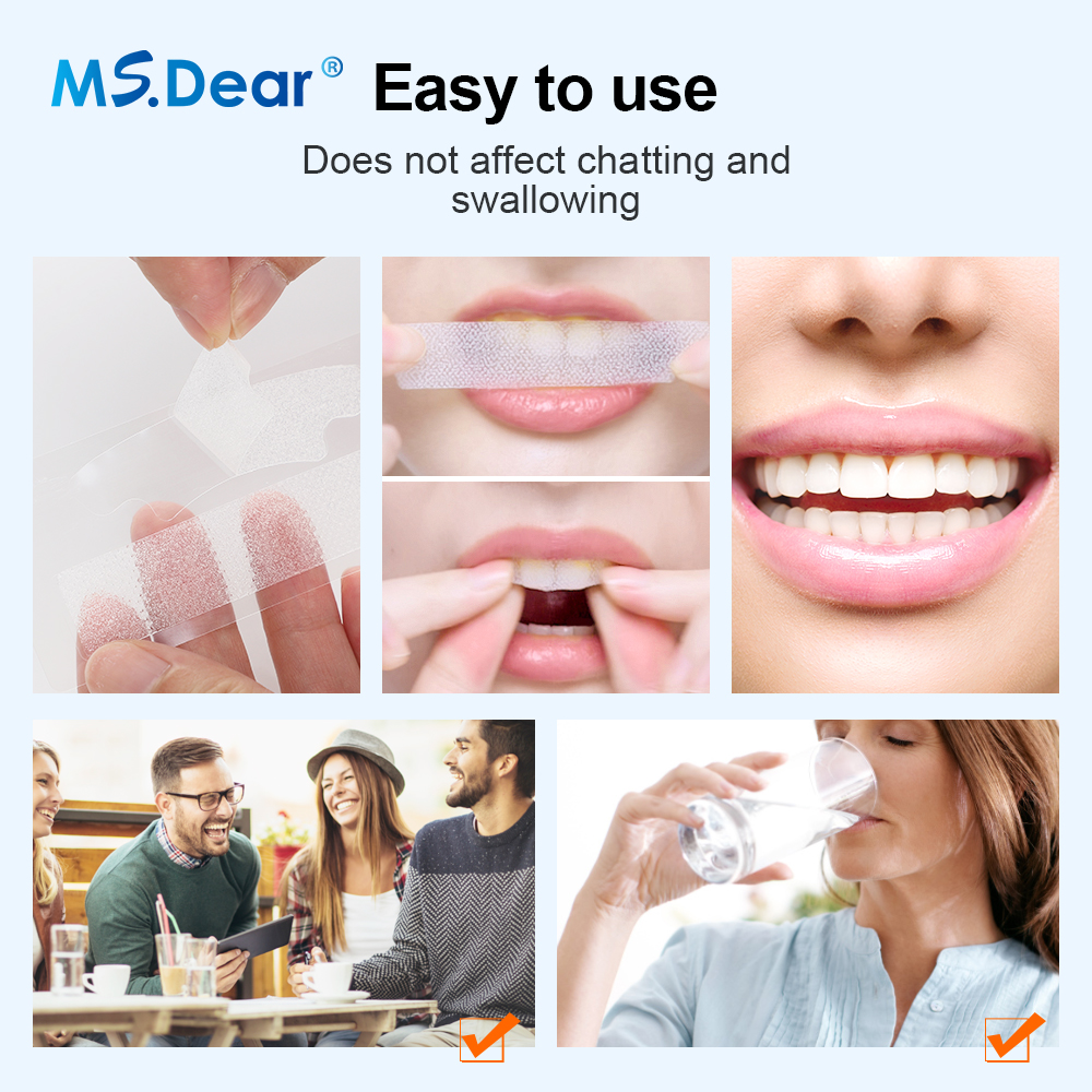 Teeth Whitening Strips Cleansi - Teeth Whitening Strips Crest recensie en prijs